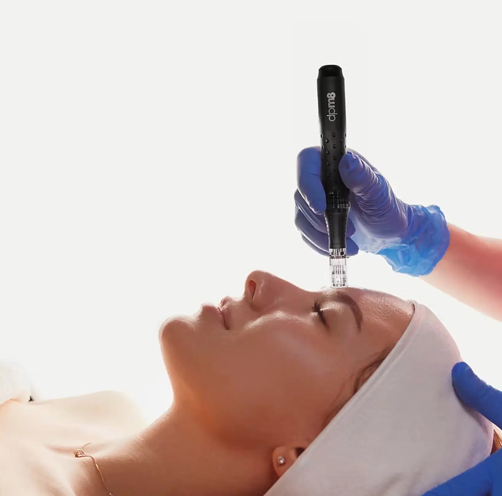 Trajtim microneedling me pen në ballë