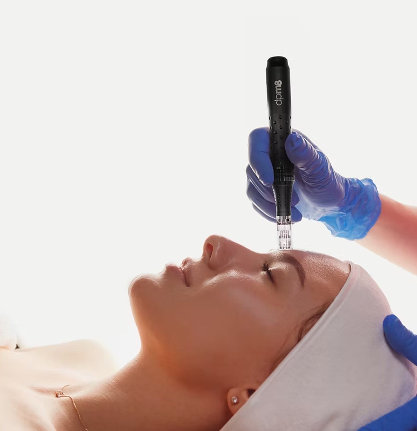 Trajtim me pen microneedling në fytyrë