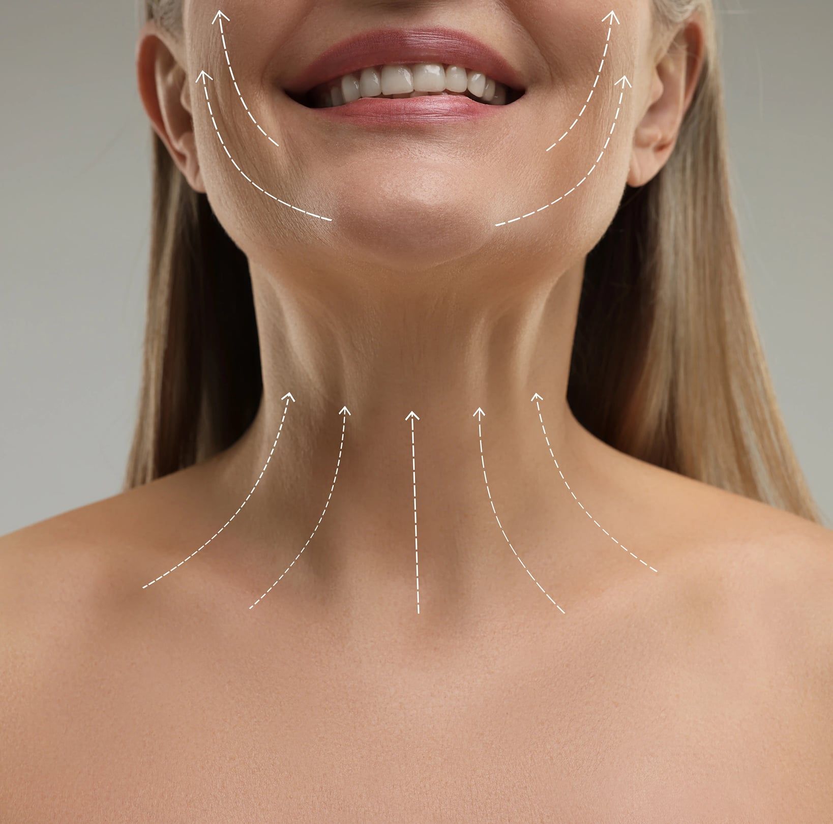 Qafë me shigjeta që tregojnë efektin lifting të Nefretiti Neck